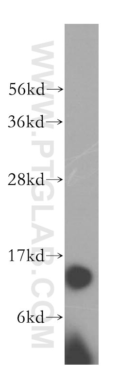 Western Blot (WB) analysis of human brain tissue using THEM2 Polyclonal antibody (16782-1-AP)