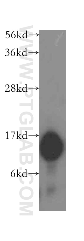 Western Blot (WB) analysis of mouse kidney tissue using THEM2 Polyclonal antibody (16782-1-AP)