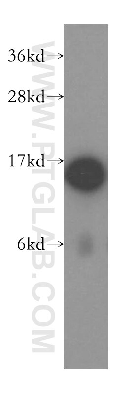 Western Blot (WB) analysis of human liver tissue using THEM2 Polyclonal antibody (16782-1-AP)