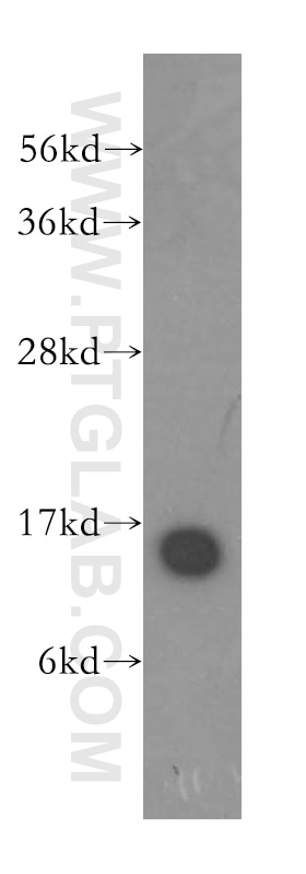 Western Blot (WB) analysis of HeLa cells using THEM2 Polyclonal antibody (16782-1-AP)