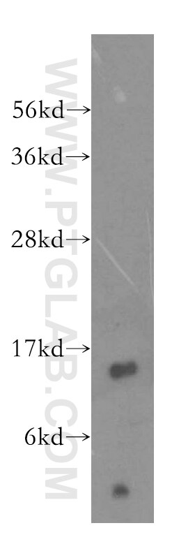 Western Blot (WB) analysis of human colon tissue using THEM2 Polyclonal antibody (16782-1-AP)