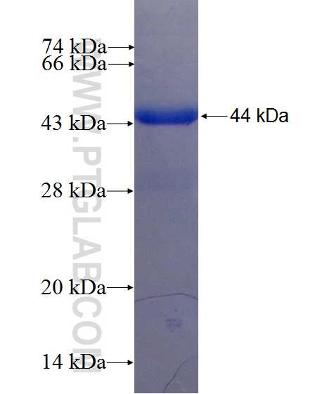 THEM2 fusion protein Ag10212 SDS-PAGE