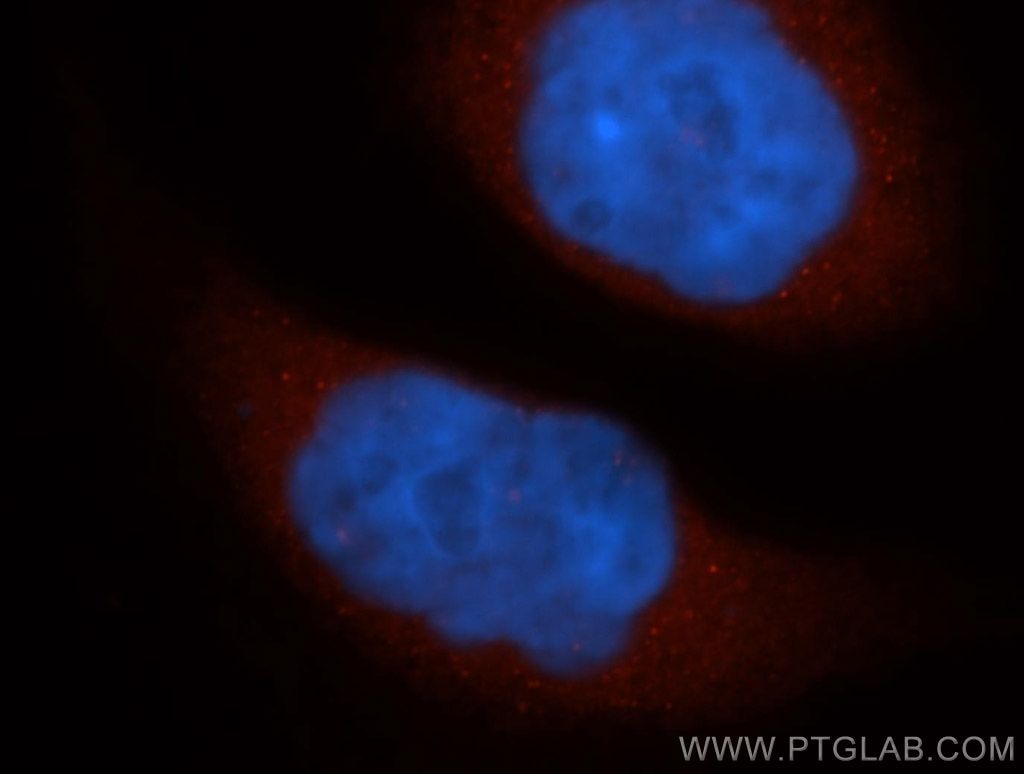 Immunofluorescence (IF) / fluorescent staining of HeLa cells using CTMP Polyclonal antibody (14692-1-AP)