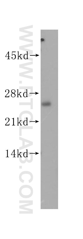 Western Blot (WB) analysis of mouse skeletal muscle tissue using CTMP Polyclonal antibody (14692-1-AP)