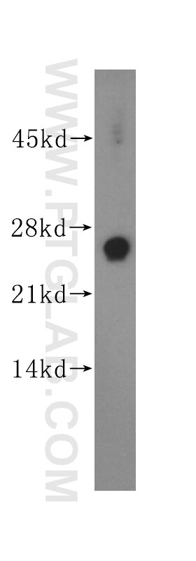 Western Blot (WB) analysis of mouse brain tissue using CTMP Polyclonal antibody (14692-1-AP)