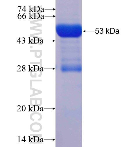 THEM4 fusion protein Ag6244 SDS-PAGE