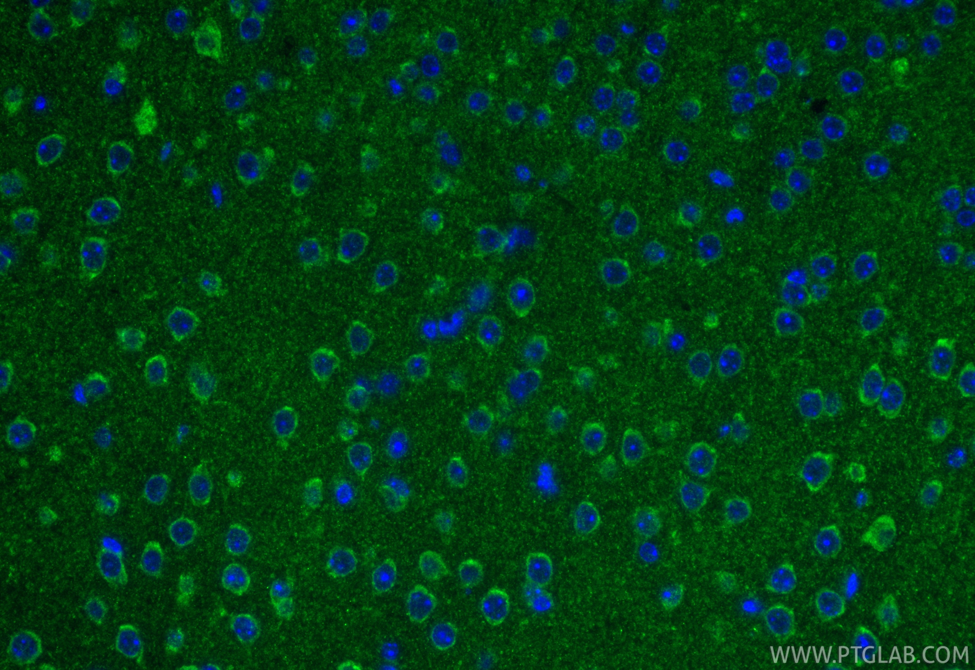 Immunofluorescence (IF) / fluorescent staining of mouse brain tissue using THG1L Polyclonal antibody (15208-1-AP)