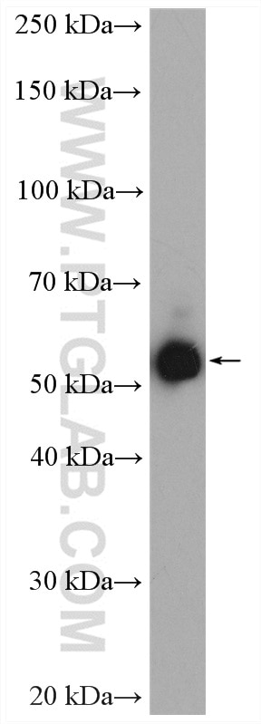 Western Blot (WB) analysis of HEK-293 cells using THNSL2 Polyclonal antibody (17573-1-AP)
