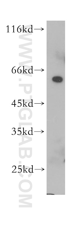Western Blot (WB) analysis of HeLa cells using THNSL2 Polyclonal antibody (17573-1-AP)