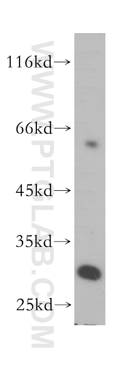 Western Blot (WB) analysis of HepG2 cells using THNSL2 Polyclonal antibody (17573-1-AP)