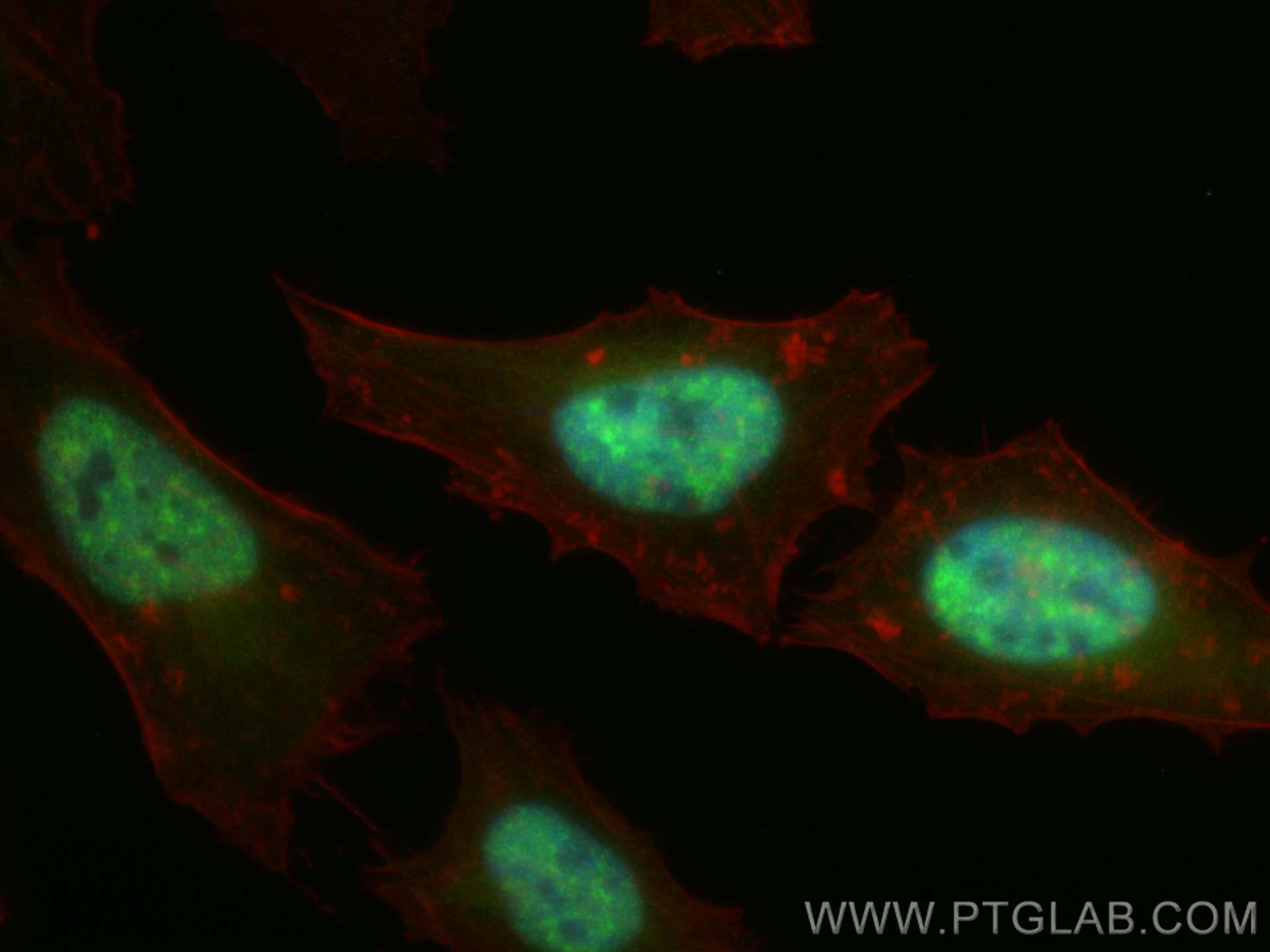 Immunofluorescence (IF) / fluorescent staining of HeLa cells using THOC1 Polyclonal antibody (10920-1-AP)