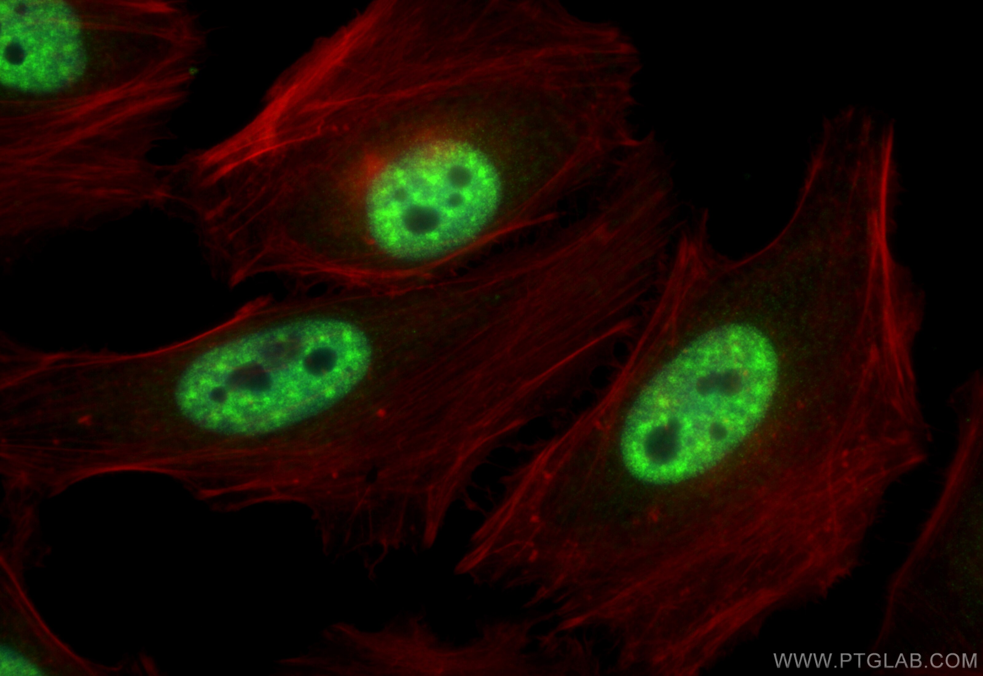 Immunofluorescence (IF) / fluorescent staining of HeLa cells using THOC1 Polyclonal antibody (10920-1-AP)