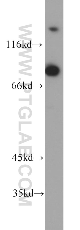 Western Blot (WB) analysis of HEK-293 cells using THOC1 Polyclonal antibody (10920-1-AP)