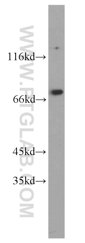 Western Blot (WB) analysis of HEK-293 cells using THOC1 Polyclonal antibody (10920-1-AP)