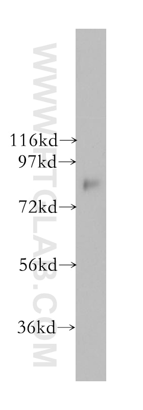 Western Blot (WB) analysis of HEK-293 cells using THOC1 Polyclonal antibody (10920-1-AP)