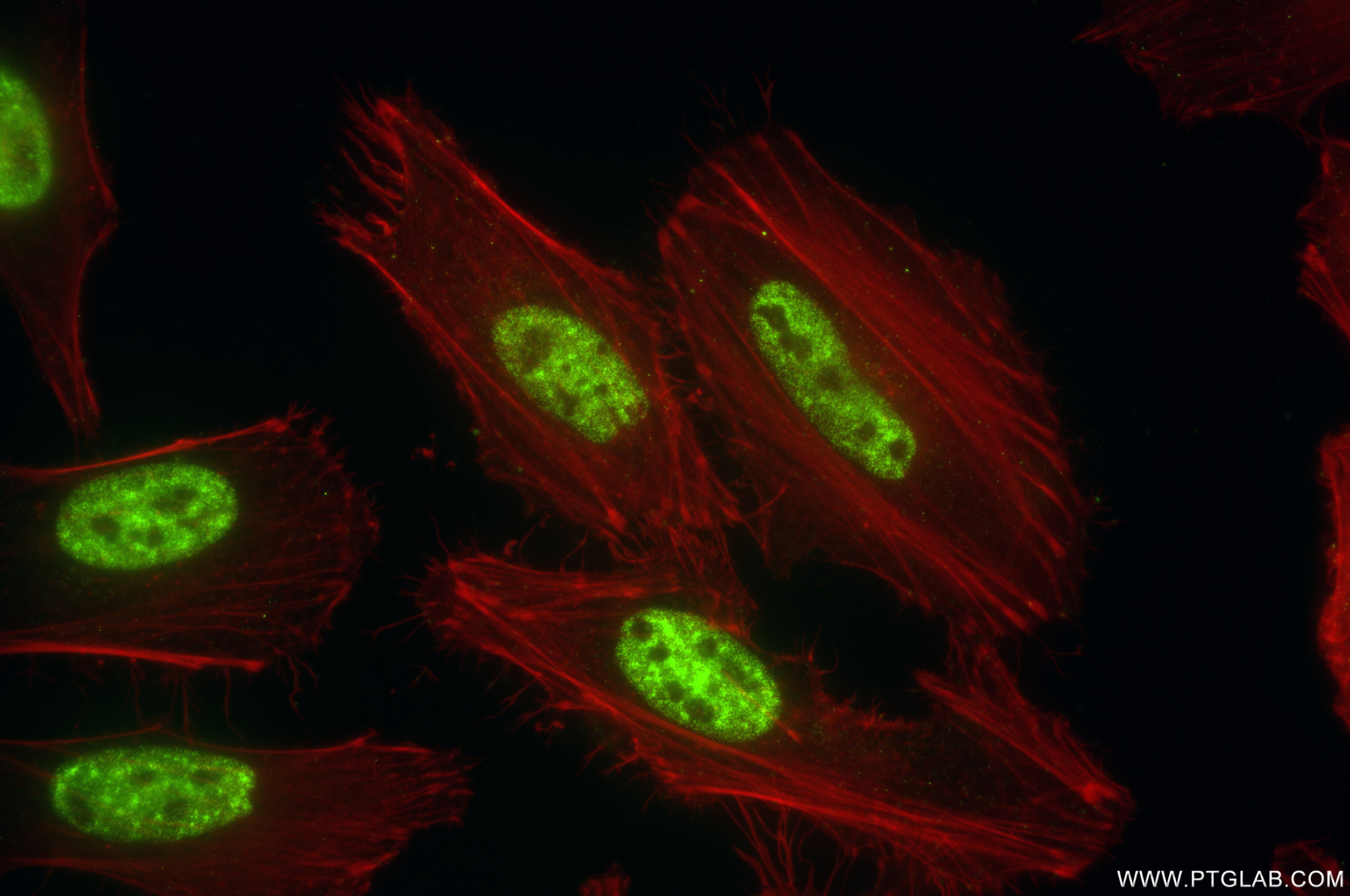 Immunofluorescence (IF) / fluorescent staining of HeLa cells using THOC1 Recombinant antibody (85642-5-RR)