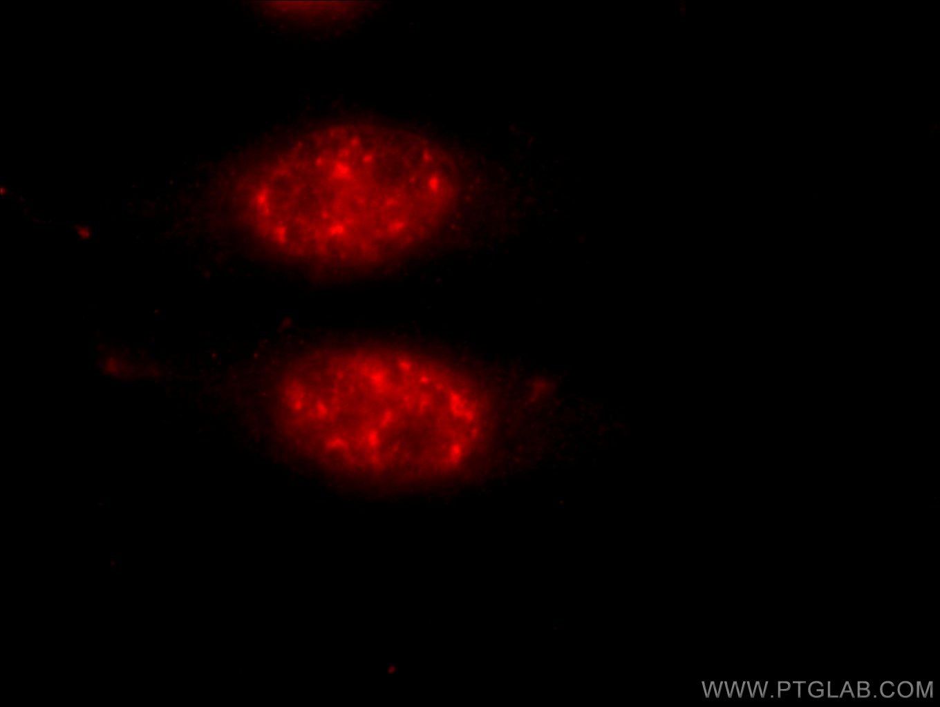 Immunofluorescence (IF) / fluorescent staining of HeLa cells using THOC2 Polyclonal antibody (55178-1-AP)