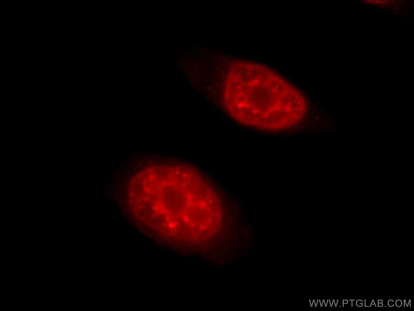 Immunofluorescence (IF) / fluorescent staining of HeLa cells using THOC2 Polyclonal antibody (55178-1-AP)