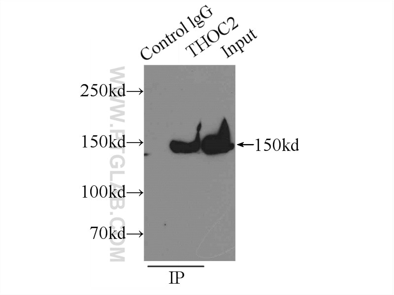 Immunoprecipitation (IP) experiment of HeLa cells using THOC2 Polyclonal antibody (55178-1-AP)