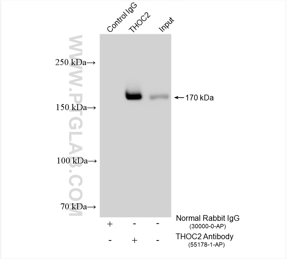 Immunoprecipitation (IP) experiment of HeLa cells using THOC2 Polyclonal antibody (55178-1-AP)