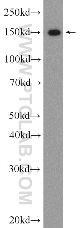 Western Blot (WB) analysis of HeLa cells using THOC2 Polyclonal antibody (55178-1-AP)