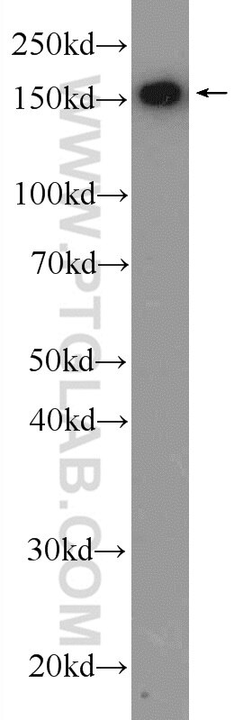 Western Blot (WB) analysis of Jurkat cells using THOC2 Polyclonal antibody (55178-1-AP)