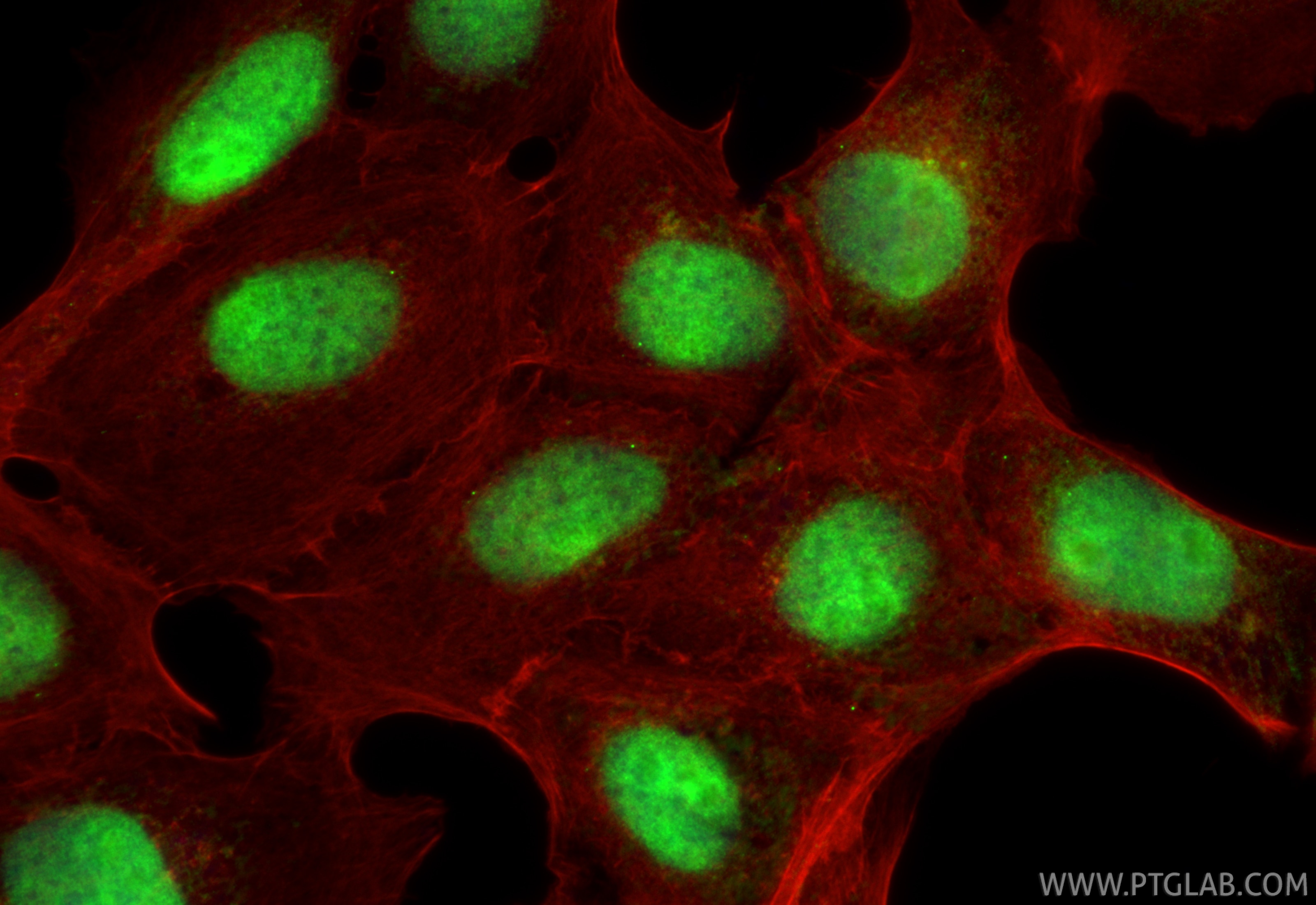 Immunofluorescence (IF) / fluorescent staining of A431 cells using THOC3 Monoclonal antibody (68812-3-Ig)