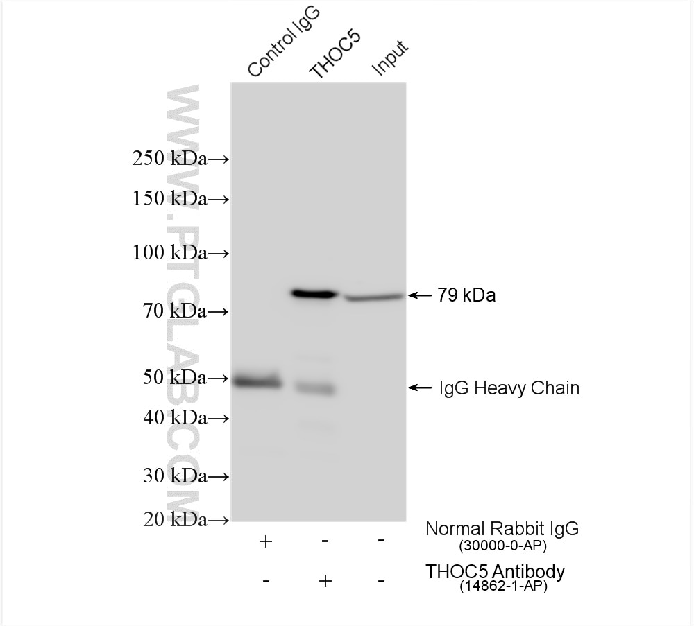 Immunoprecipitation (IP) experiment of HEK-293 cells using THOC5 Polyclonal antibody (14862-1-AP)