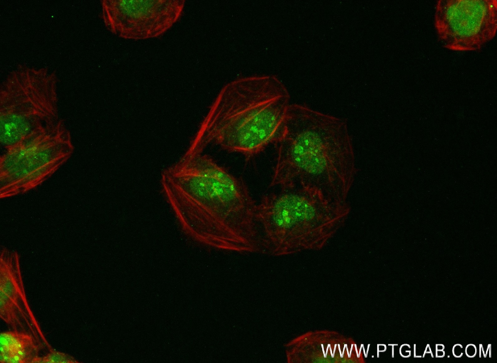 Immunofluorescence (IF) / fluorescent staining of U2OS cells using THOC5 Recombinant antibody (83435-1-RR)