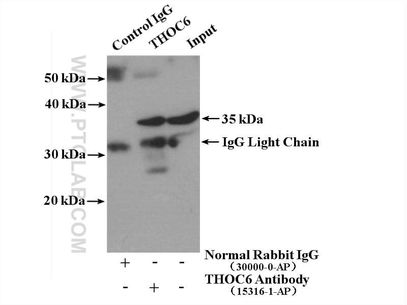 Immunoprecipitation (IP) experiment of A431 cells using THOC6 Polyclonal antibody (15316-1-AP)