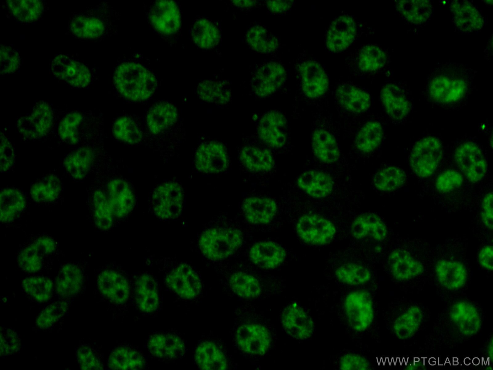 Immunofluorescence (IF) / fluorescent staining of A431 cells using THOC7 Polyclonal antibody (17881-1-AP)