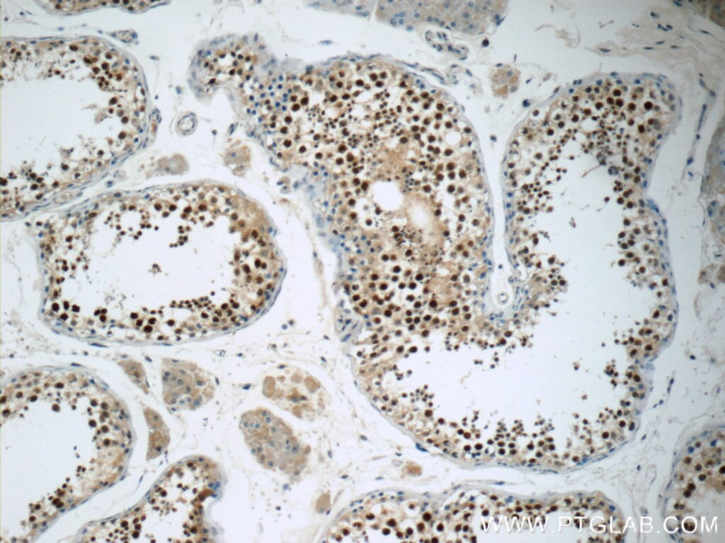 Immunohistochemistry (IHC) staining of human testis tissue using THOC7 Polyclonal antibody (17881-1-AP)