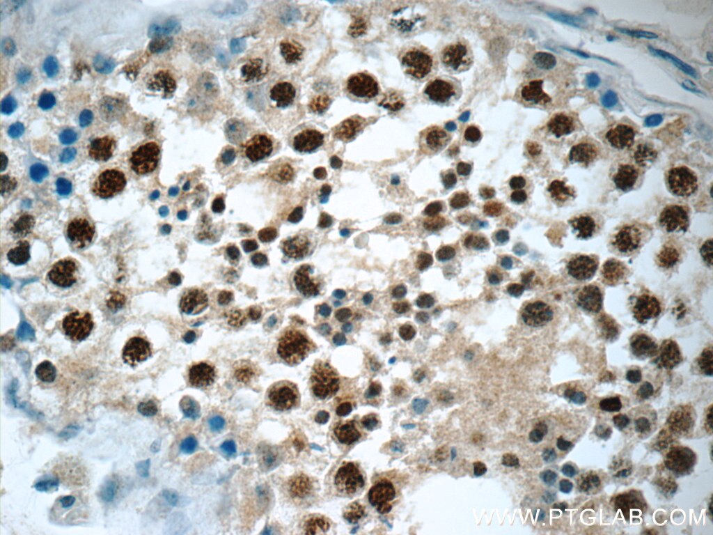 IHC staining of human testis using 17881-1-AP