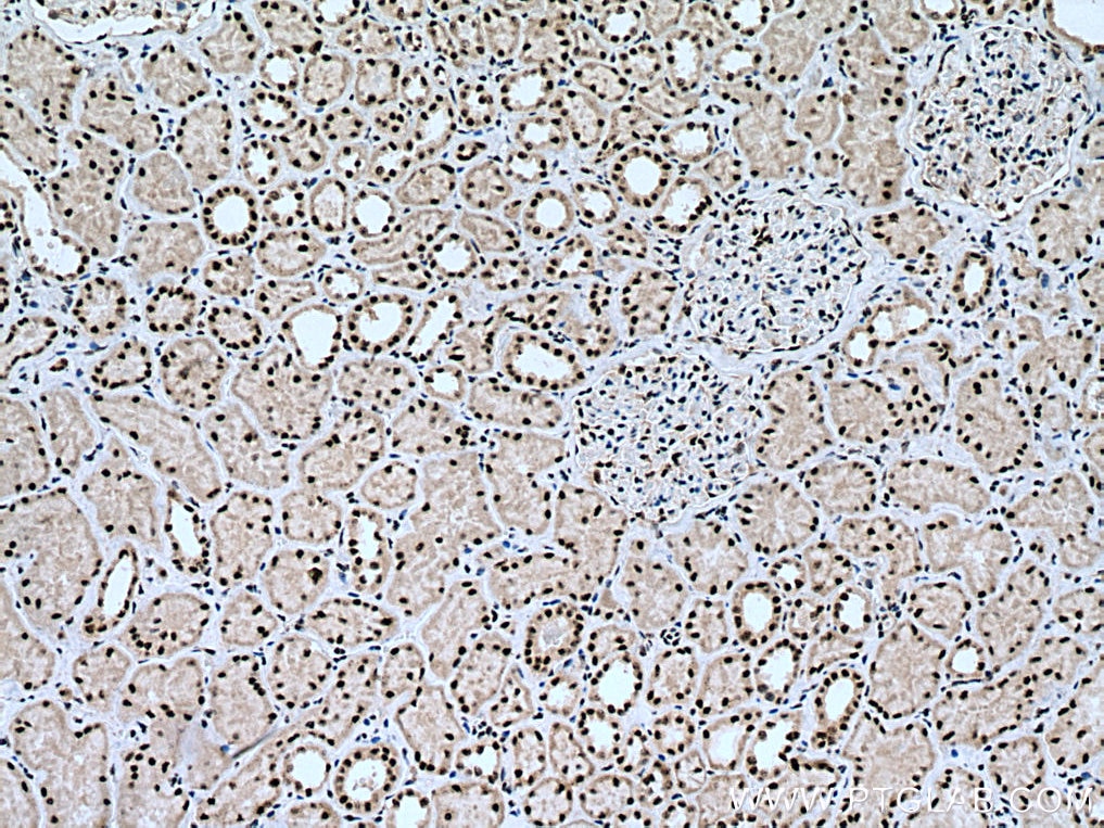 Immunohistochemistry (IHC) staining of human kidney tissue using THOC7 Polyclonal antibody (17881-1-AP)