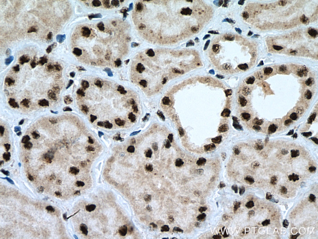 Immunohistochemistry (IHC) staining of human kidney tissue using THOC7 Polyclonal antibody (17881-1-AP)