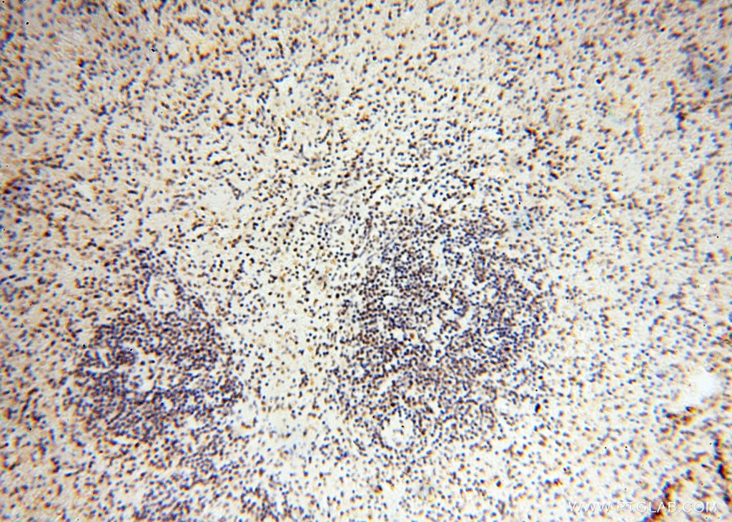 Immunohistochemistry (IHC) staining of human spleen tissue using THOC7 Polyclonal antibody (17881-1-AP)