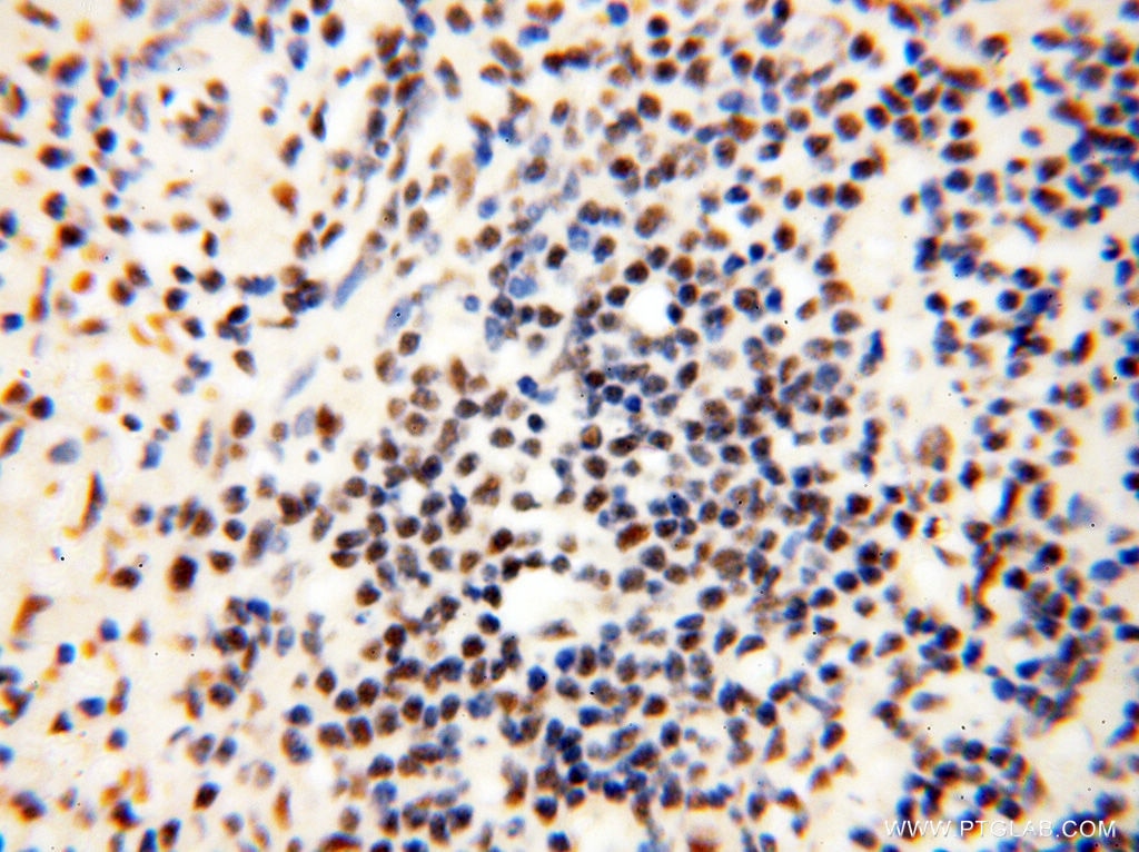 Immunohistochemistry (IHC) staining of human spleen tissue using THOC7 Polyclonal antibody (17881-1-AP)