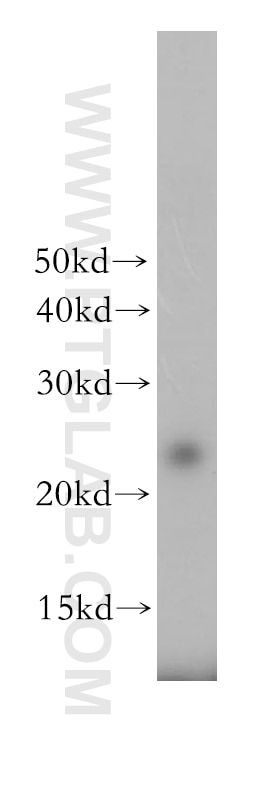 Western Blot (WB) analysis of human liver tissue using THOC7 Polyclonal antibody (17881-1-AP)