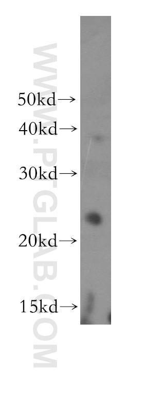 Western Blot (WB) analysis of HEK-293 cells using THOC7 Polyclonal antibody (17881-1-AP)