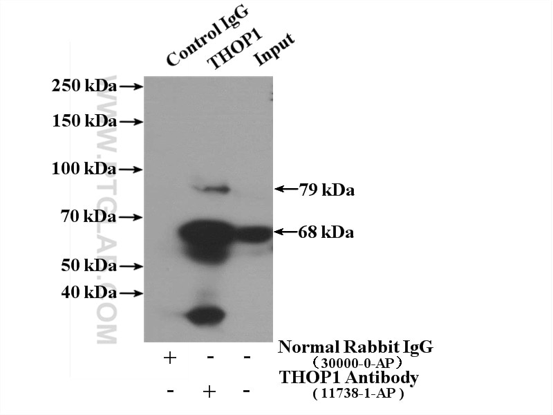 Immunoprecipitation (IP) experiment of human placenta tissue using THOP1 Polyclonal antibody (11738-1-AP)