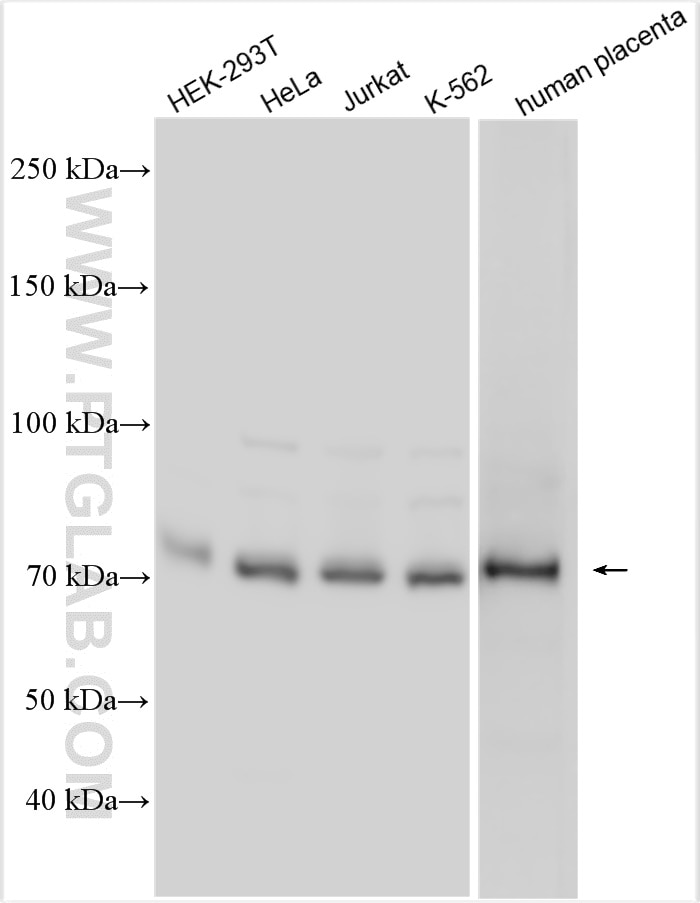 Western Blot (WB) analysis of various lysates using THOP1 Polyclonal antibody (11738-1-AP)