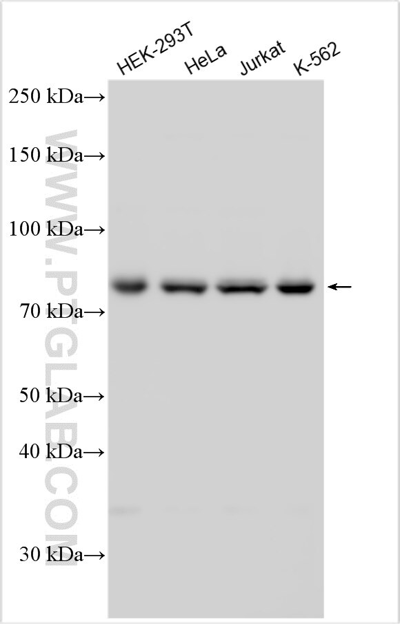 Western Blot (WB) analysis of various lysates using THOP1 Polyclonal antibody (11738-1-AP)