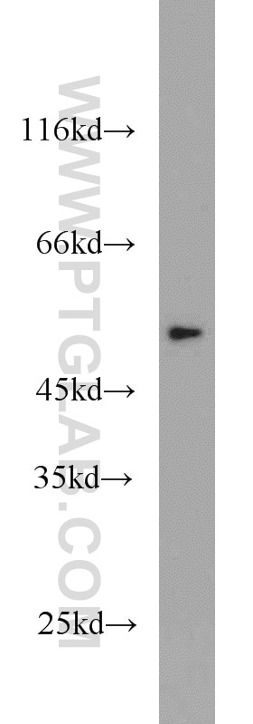 Western Blot (WB) analysis of A431 cells using THRA Polyclonal antibody (10139-1-AP)