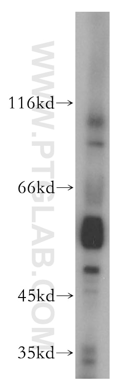 Western Blot (WB) analysis of mouse brain tissue using THRA Polyclonal antibody (10139-1-AP)