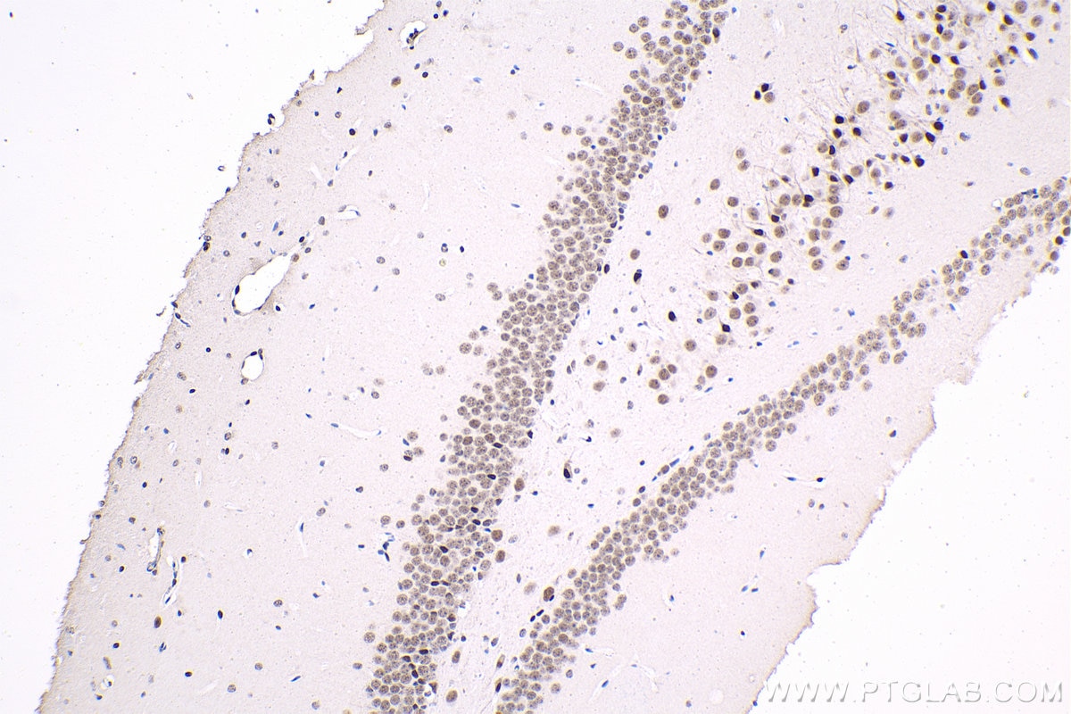 Immunohistochemistry (IHC) staining of mouse brain tissue using THRA Monoclonal antibody (66703-1-Ig)