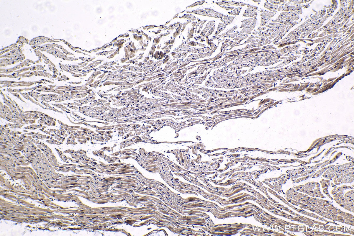 Immunohistochemistry (IHC) staining of mouse heart tissue using THRA Monoclonal antibody (66703-1-Ig)