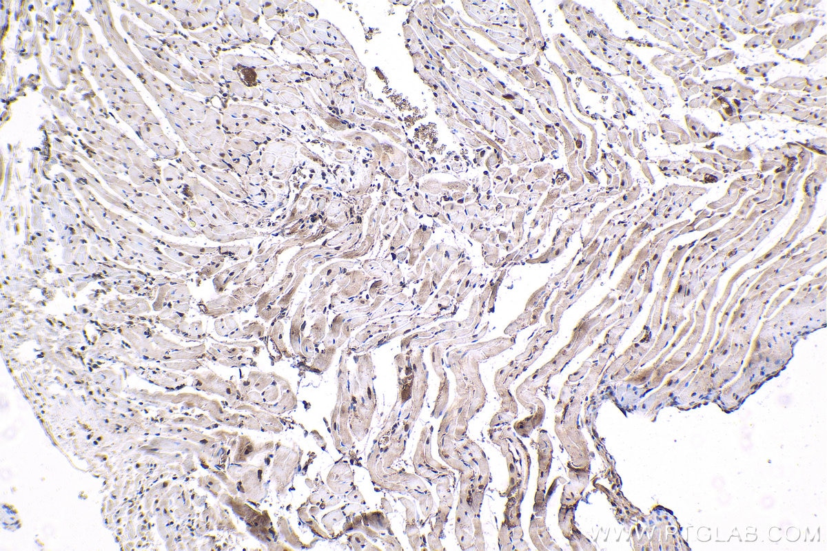 Immunohistochemistry (IHC) staining of rat heart tissue using THRA Monoclonal antibody (66703-1-Ig)