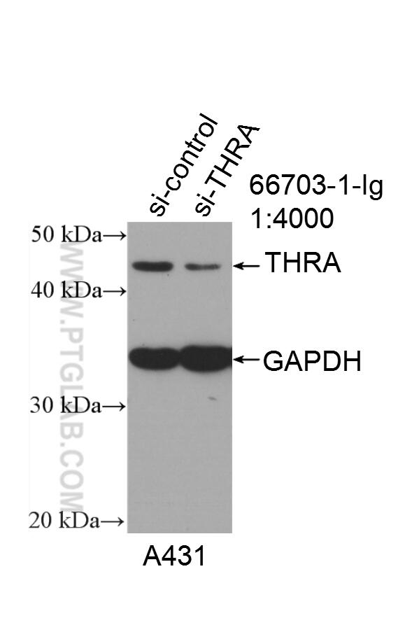 Western Blot (WB) analysis of A431 cells using THRA Monoclonal antibody (66703-1-Ig)