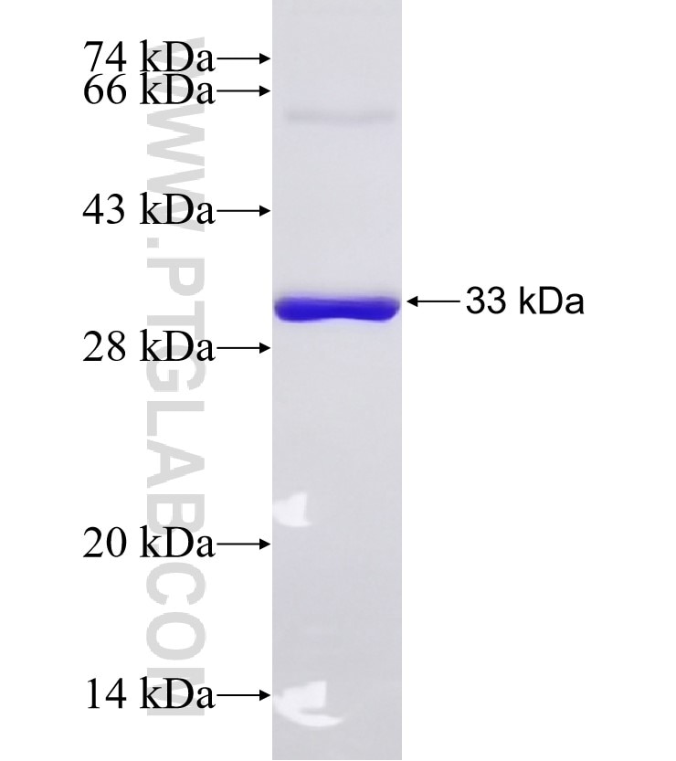 THRA fusion protein Ag27189 SDS-PAGE