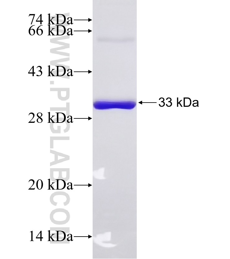 THRA fusion protein Ag27189 SDS-PAGE